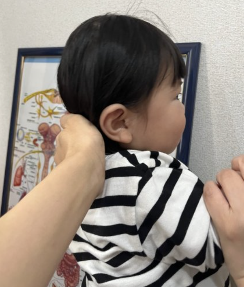 ケア後の頭の形