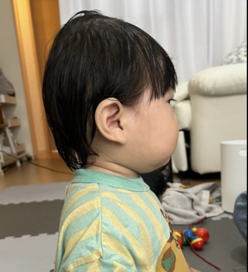 ケア前の頭の形